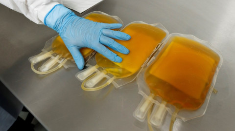 Mexicano supera COVID-19 tras recibir plasma 