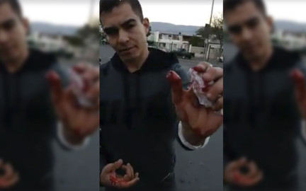 Ladrón le arranca un pedazo de dedo a automovilista