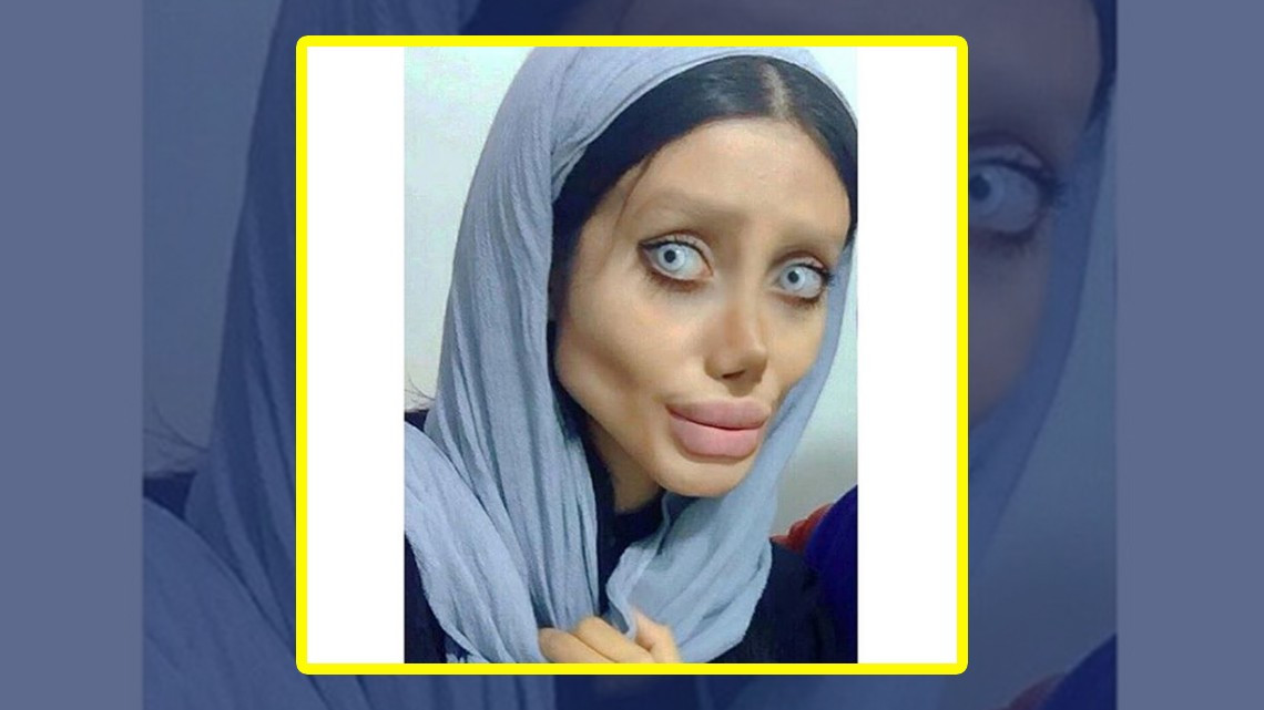 Mujer quería parecerse a Angelina Jolie pero ¡queda irreconocible!