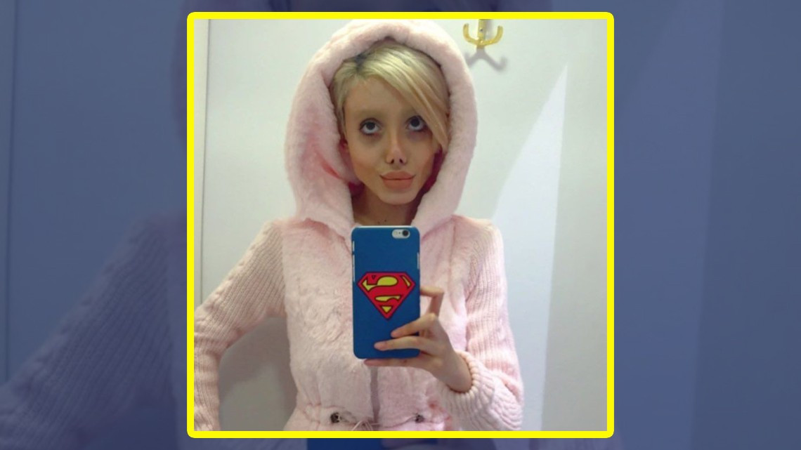 Mujer quería parecerse a Angelina Jolie pero ¡queda irreconocible!